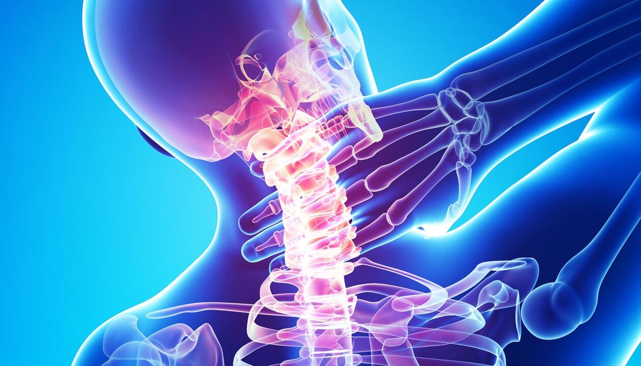 kakla sāpes osteohondrozes dēļ